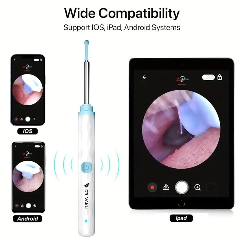 Smart Ear Cleaning Endoscope Kit - Image 5